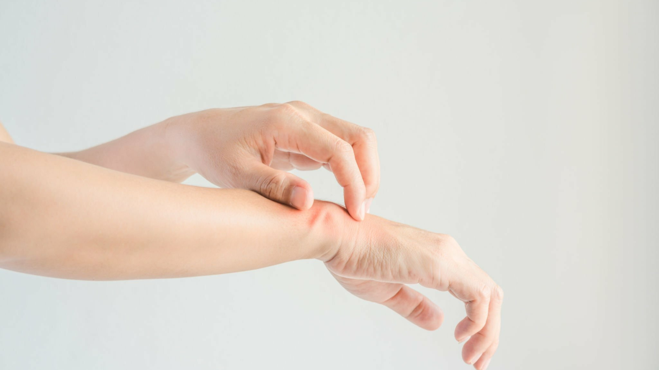 All About Hand Dermatitis What is hand Eczema